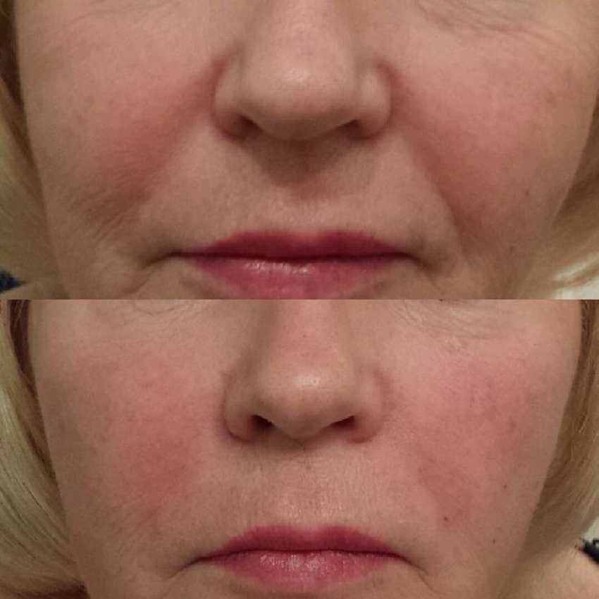 هایفو هفت بعدی